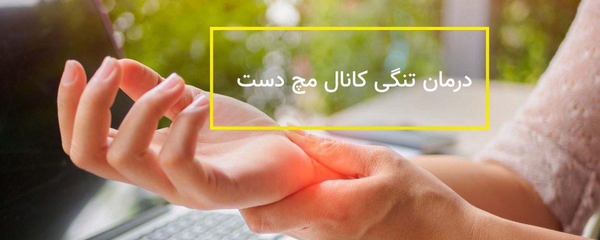 سی تی اس